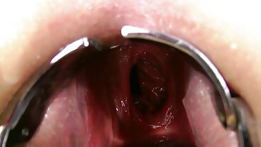 קבלו טעימה מנער השוקולד ומהדקירות סקב חינם הענקיות שלו